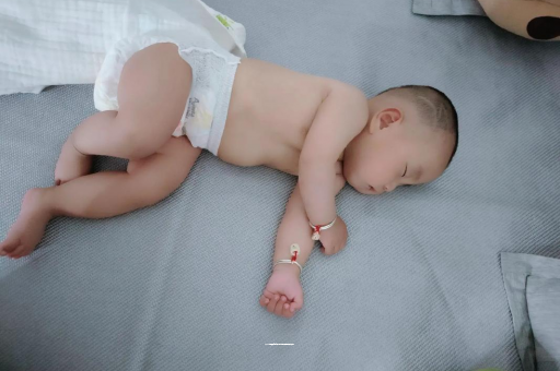 襄阳六个月宝宝眼睛散光